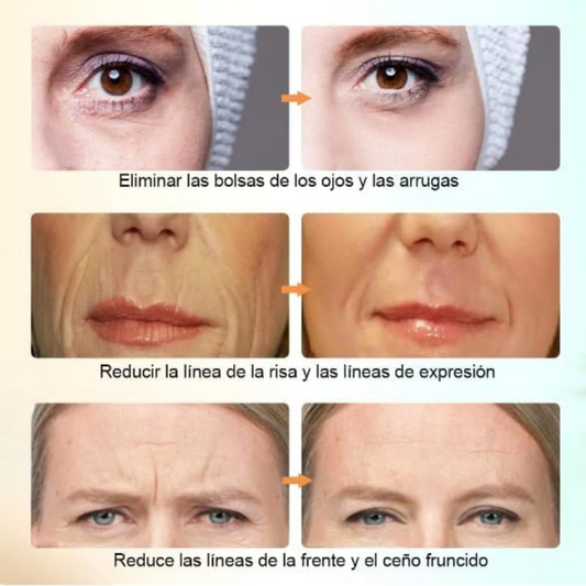 Masajeador Facial Radiofrecuencia USB