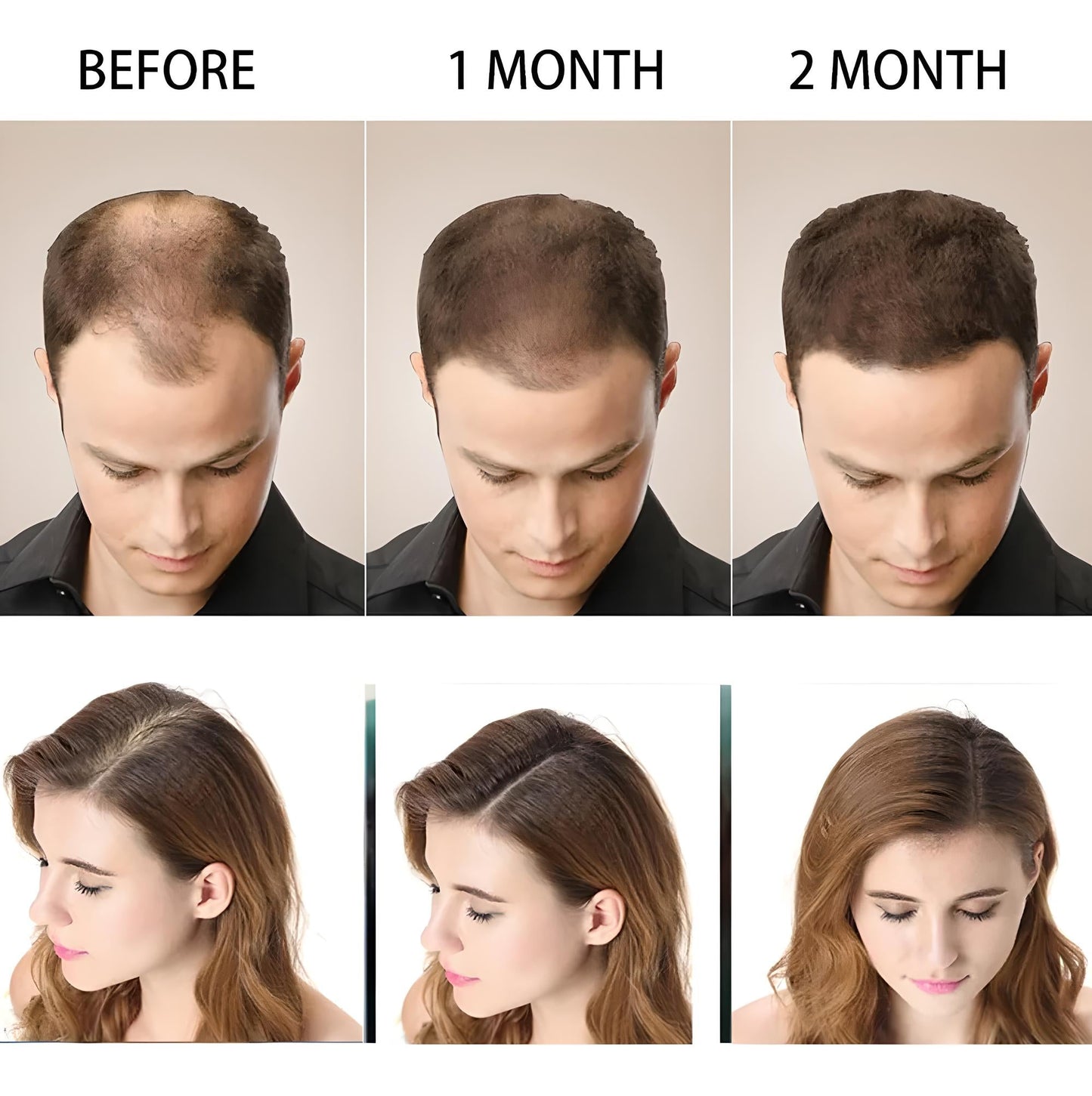 Shampoo Jabón Anti Caída Cabello Disaa