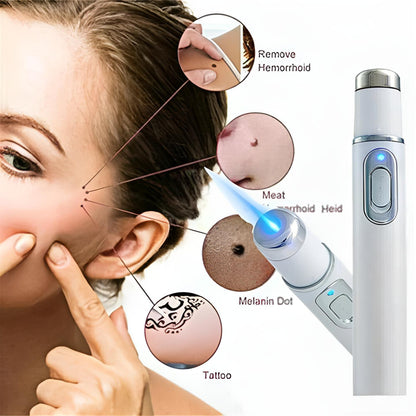 Bolígrafo luz azul removedor de acné