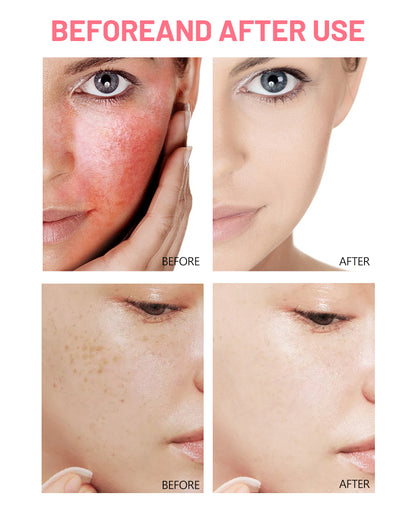 Kit Facial Disaar Rose Ceramide 5 Piezas