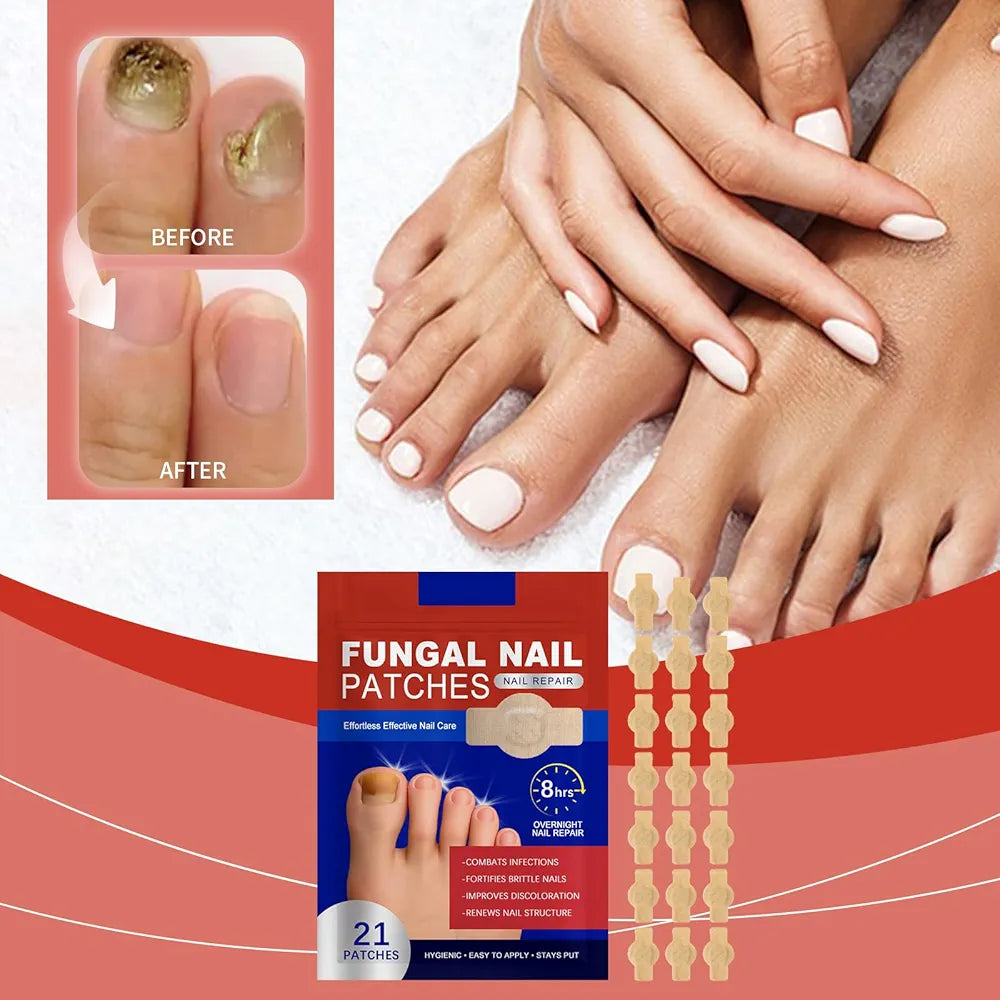 Pack 21 Parches Reparadores Uñas Hongo