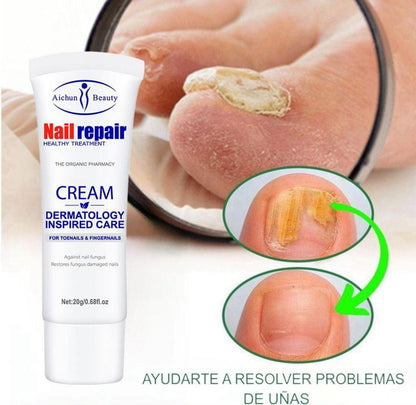 Crema Anti Hongos