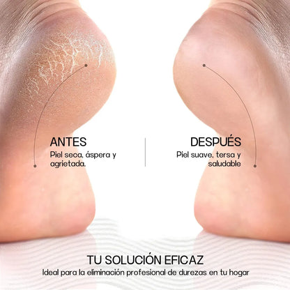 Removedor De Callos Y Durezas Eléctrico
