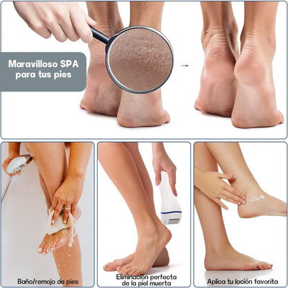 Removedor De Callos Y Durezas Eléctrico